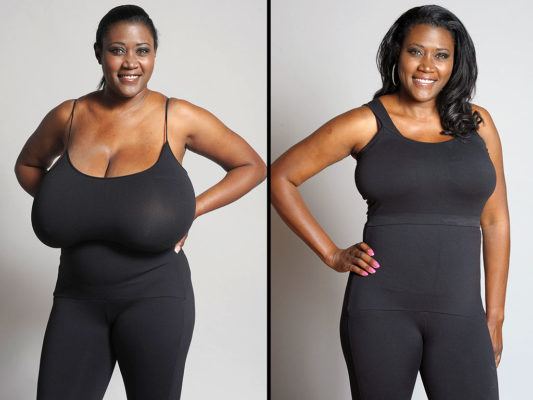 Breast reduction and Lift recovery post op garments 